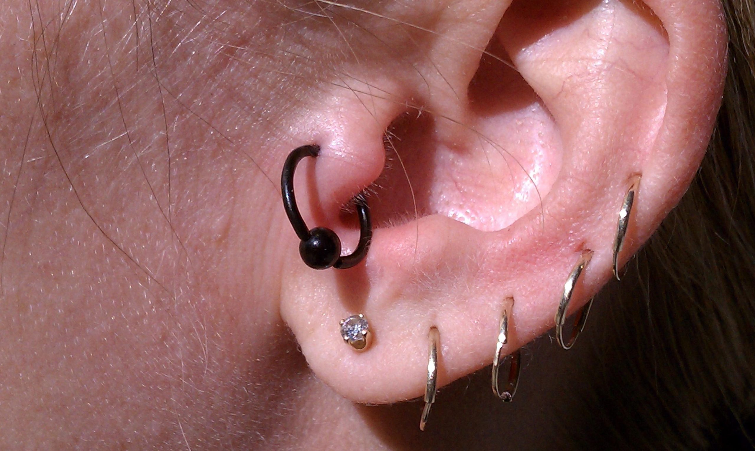 Recupera tu oreja sin dolor Cómo curar un piercing infectado en 5 pasos efectivos